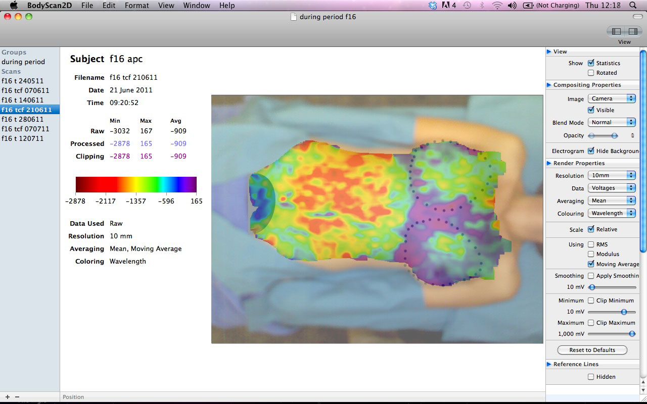 Electro-Dermal Imaging demonstration