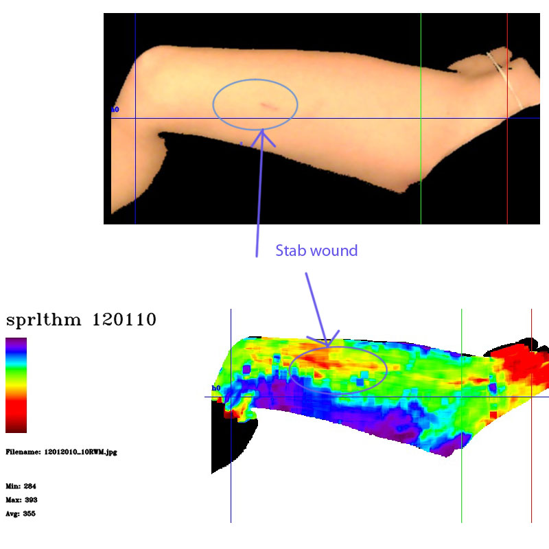 Stab Wound Scan